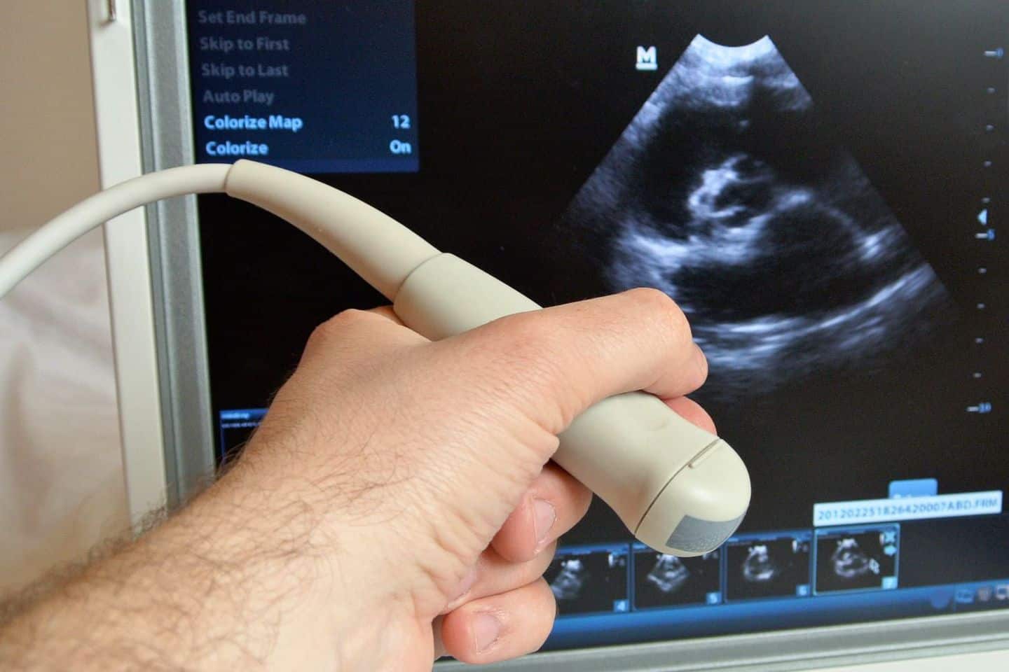 Новые аппараты для УЗИ появились в Городской поликлинике № 1