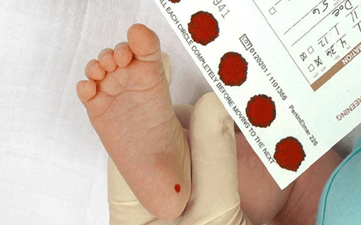 Новорожденных в Карелии будут проверять на 36 наследственных заболеваний