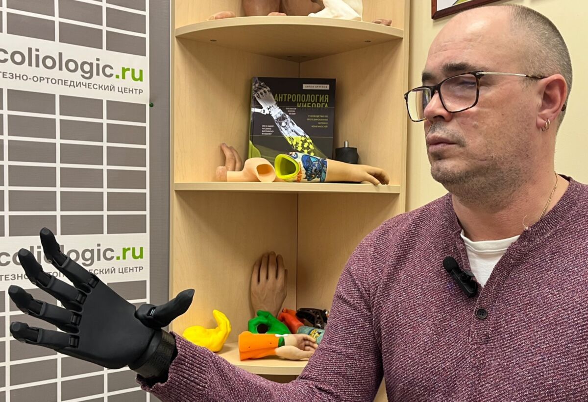 Протез руки за 7 млн рублей выдали мужчине, получившему травму на производстве