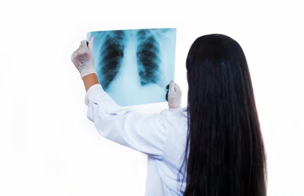 В Петрозаводске можно будет бесплатно сделать флюорографию на парковке у гипермаркета