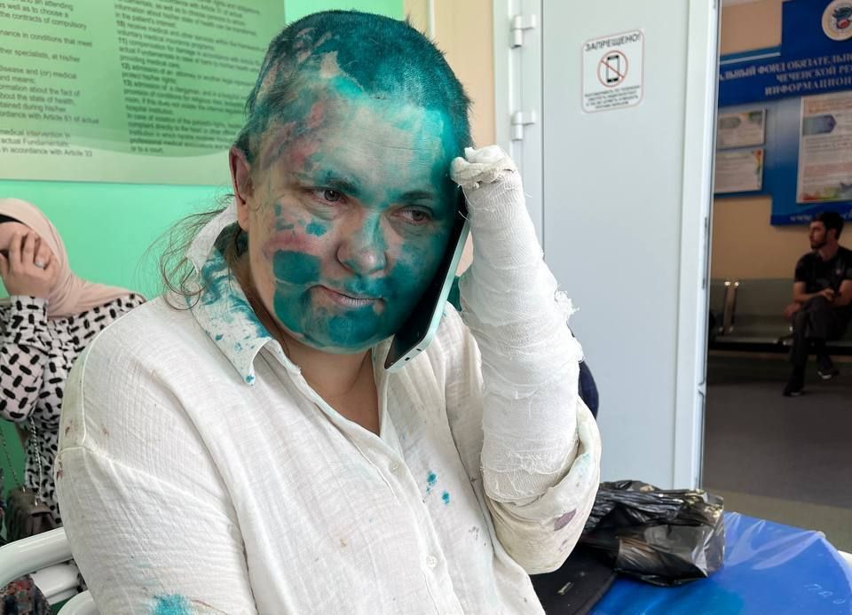 Стало известно, какие травмы получила журналист Елена Милашина во время избиения в Чечне