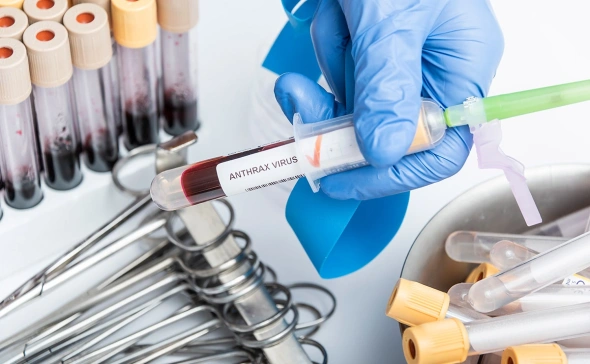 В России выявлен второй очаг распространения сибирской язвы