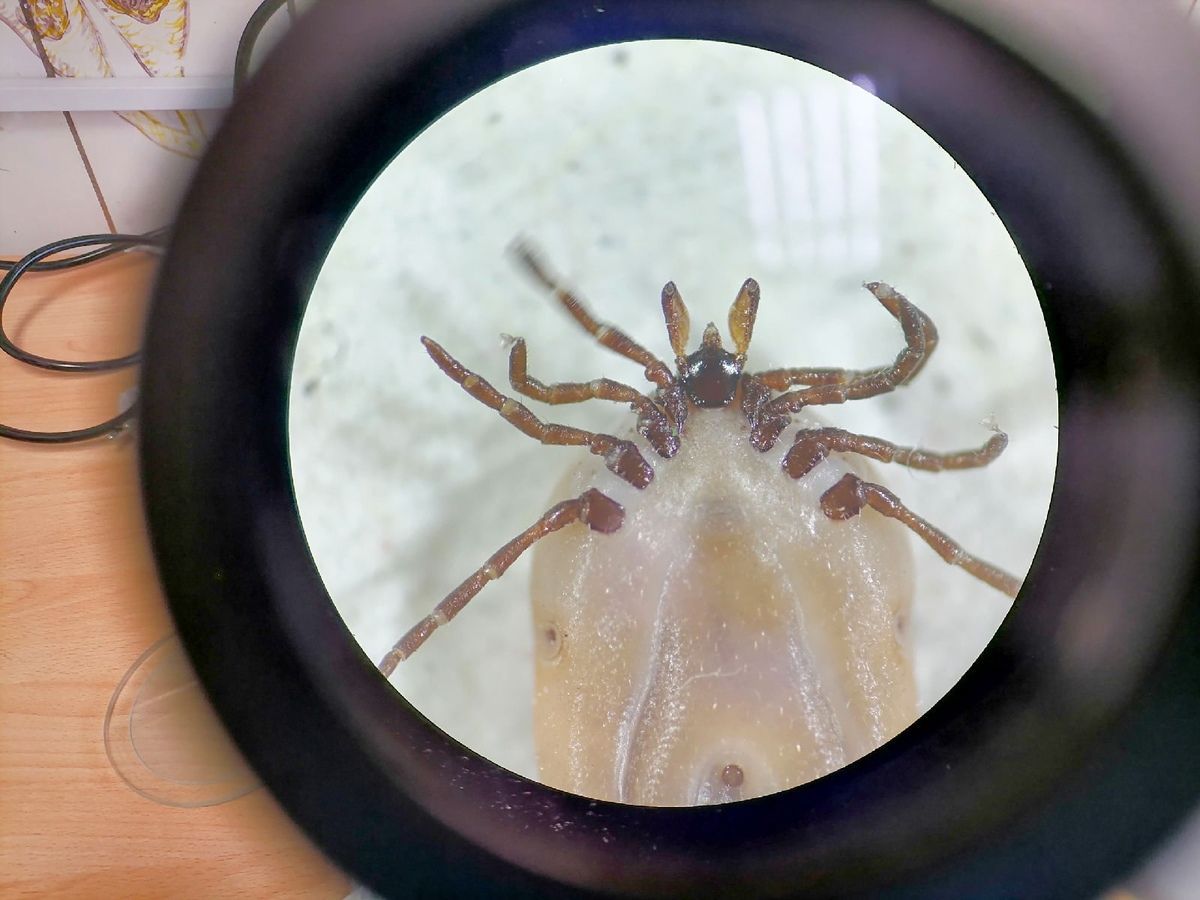 18 случаев клещевого вирусного энцефалита обнаружено у жителей Карелии в этом сезоне