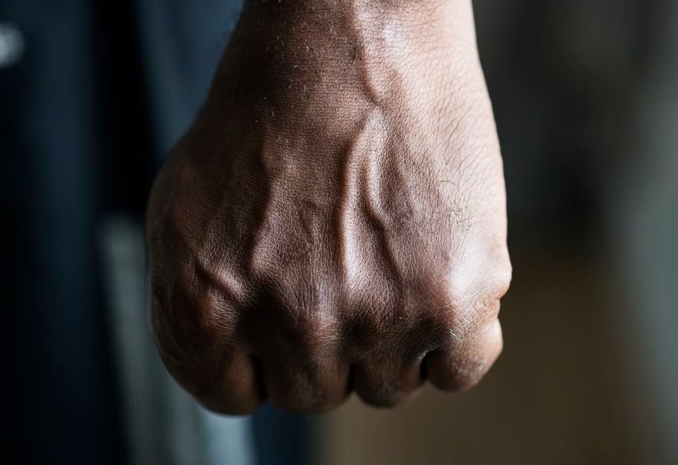 Пьяная драка в Кондопоге закончилась смертью