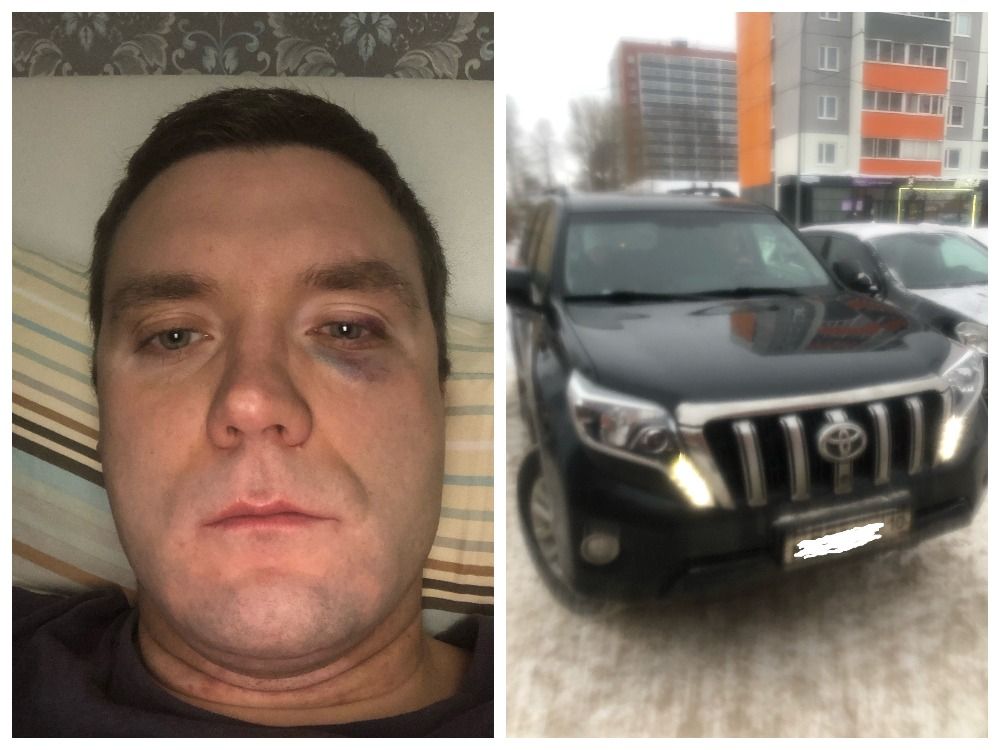 Судемедэкспертиза выяснила, кто больше пострадал в конфликте на парковке в Петрозаводске