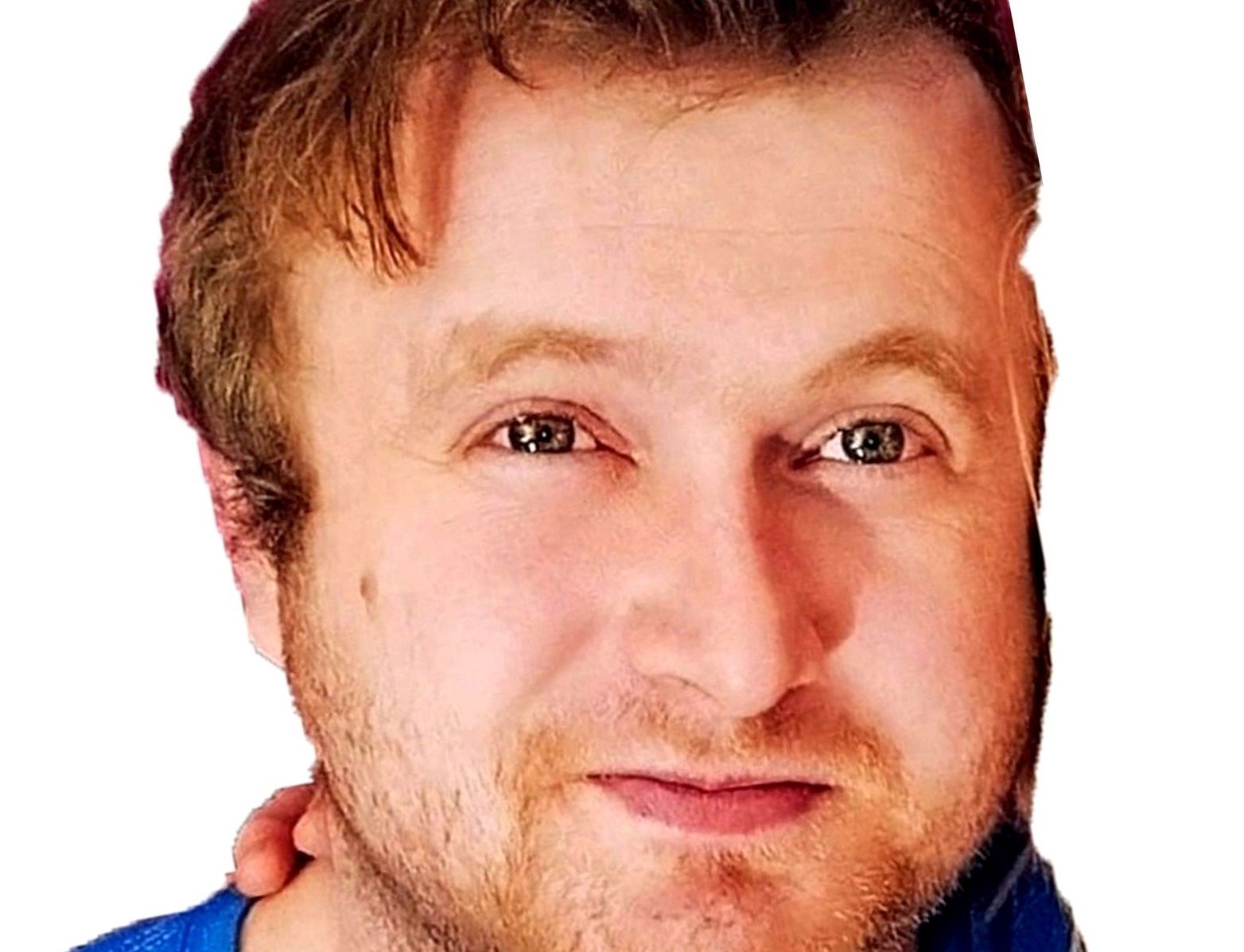 В Карелии разыскивается молодой мужчина со шрамом на лбу