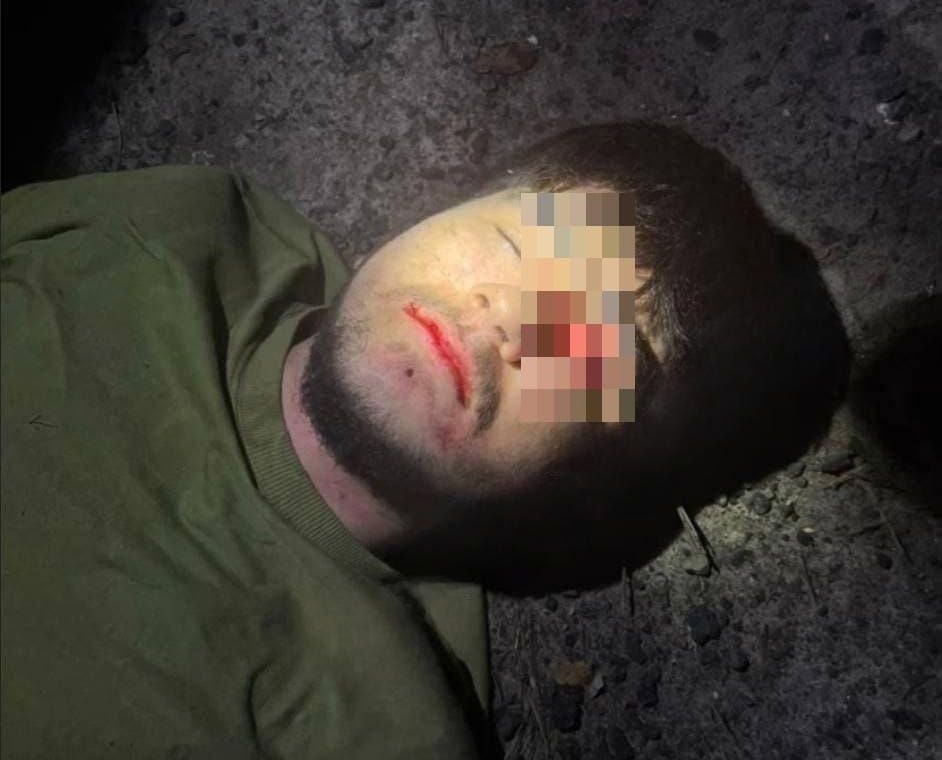 19-летний подозреваемый в теракте в Подмосковье был ранен при задержании