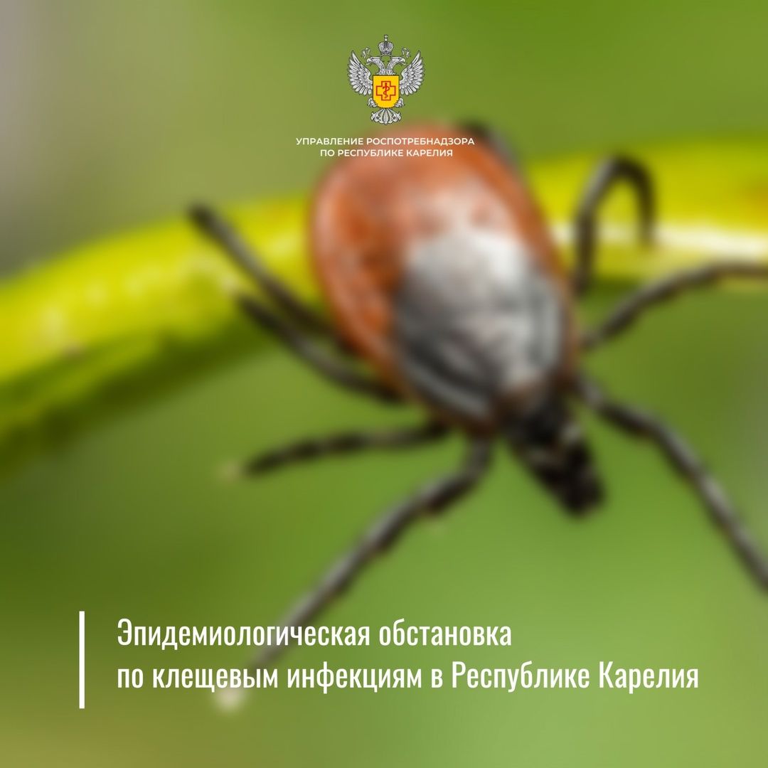 В Карелии зарегистрирован первый случай клещевого боррелиоза у ребёнка в этом году