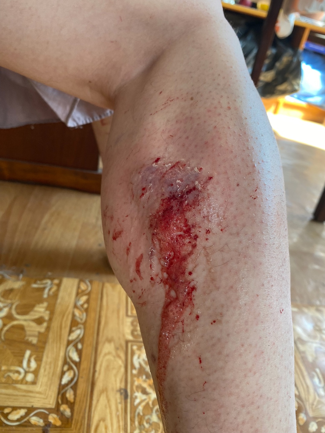 Рыжая собака искусала человека в Соломенном