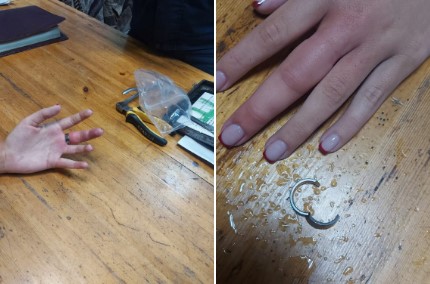 Кольцо с WB едва не стоило девушке пальца