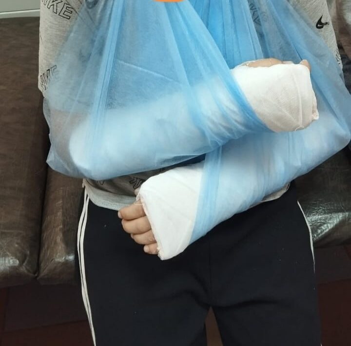 Врачи прояснили ситуацию с мальчиком из Лахденпохьи, перелом обеих рук которому поставили не сразу