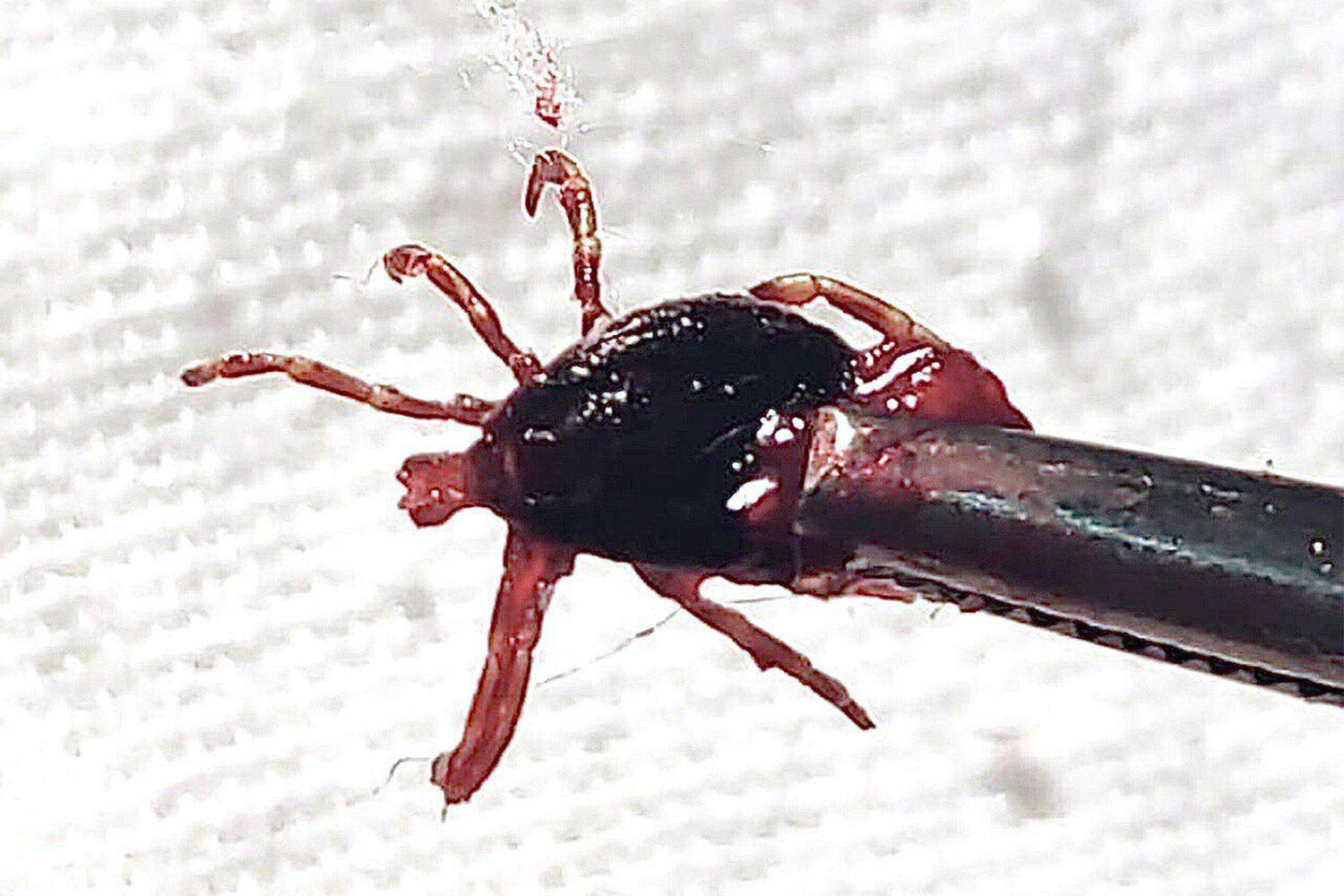 Клещи продолжают атаковать жителей Карелии