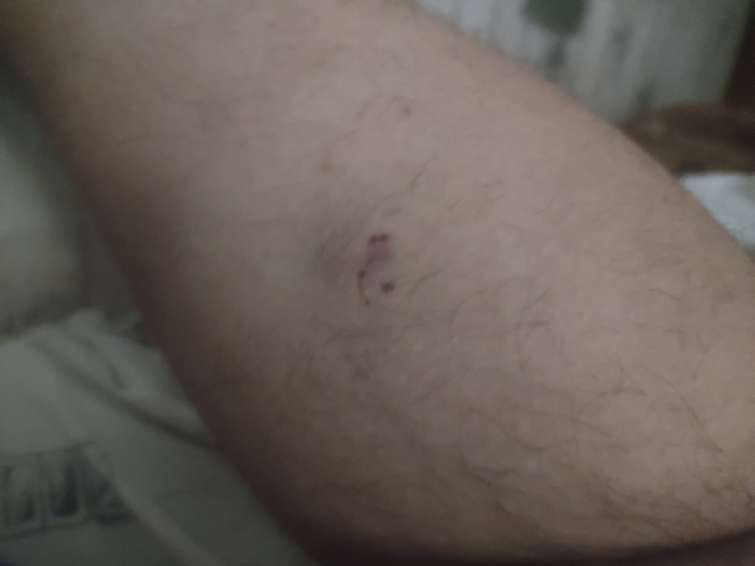 Собака покусала горожанина у магазина в Петрозаводске