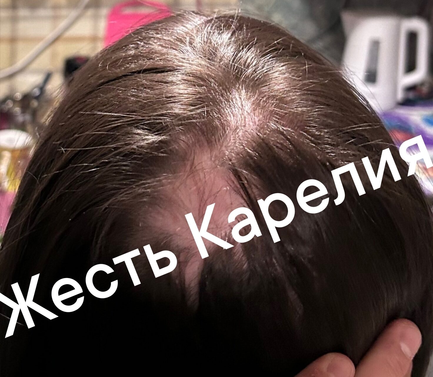 Неадекватный житель поселка Карелии рвал волосы женщинам на дискотеке