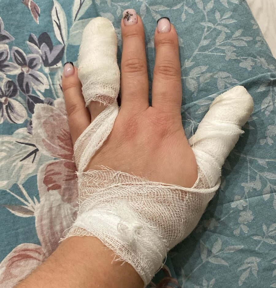 Белый бультерьер напал на женщину с чихуахуа в Питкяранте