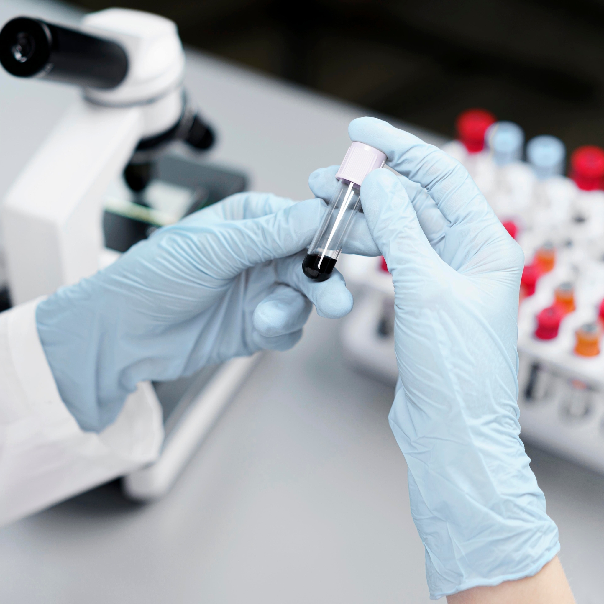 Терапевт из Петрозаводска рассказала, какие анализы стоит сдавать даже здоровым людям