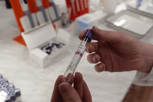 Карельские ученые провели мастер-класс по забору крови у форели