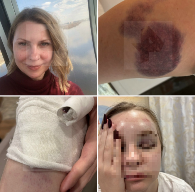 Стало известно, кто пострадал на опрокинутом судне в Карелии