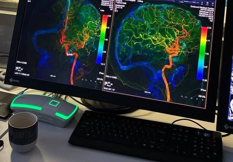 В Карелии успешно применяют технологии искусственного интеллекта врачи республики