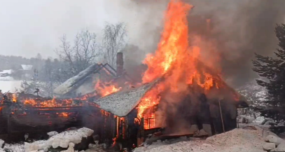При пожаре в деревне Нурмолицы пострадал ребенок