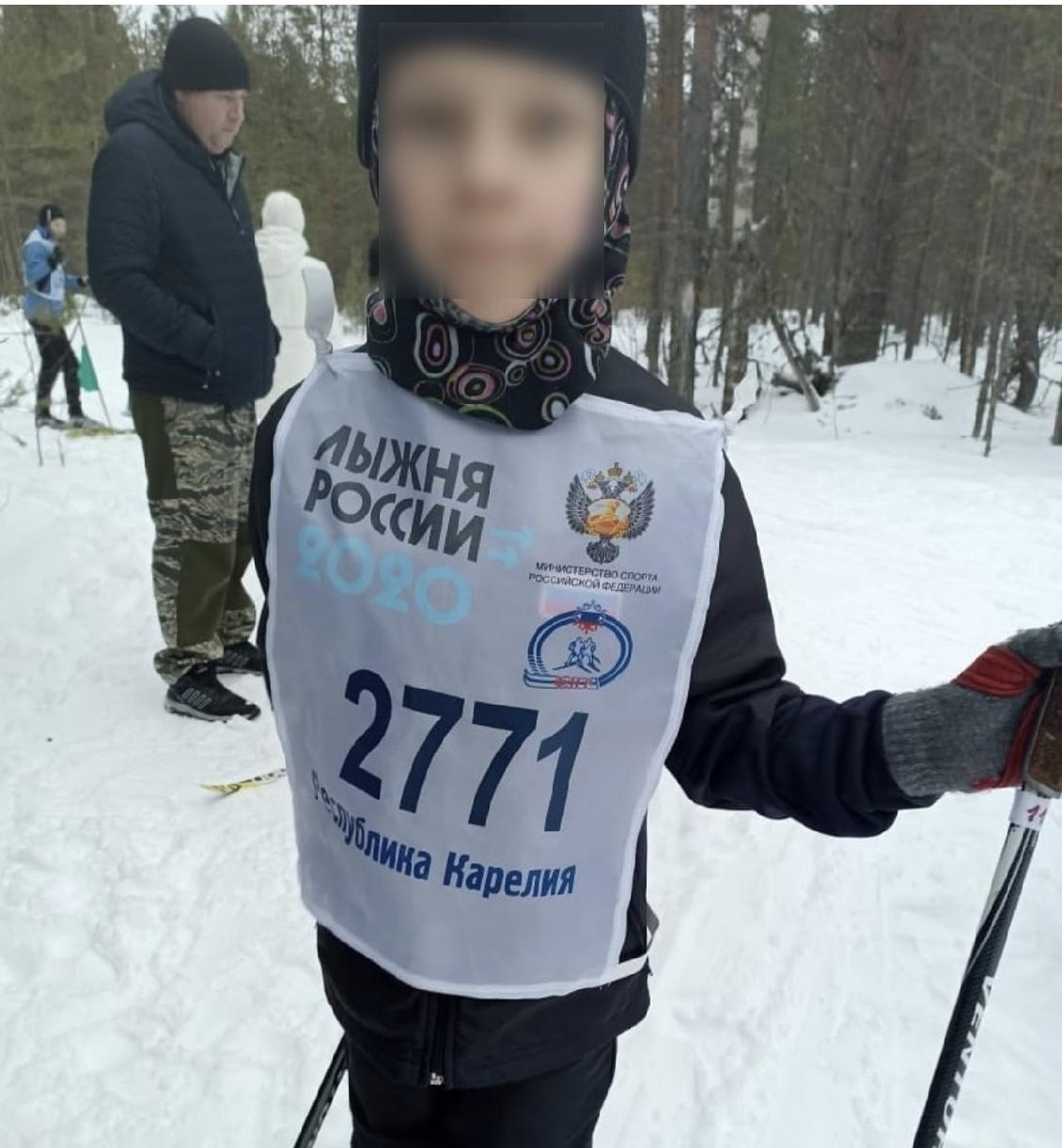 Детское баловство обернулось тяжелыми травмами в поселковой школе Карелии