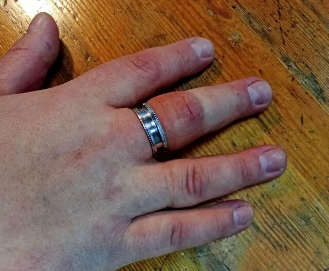 Жительница Петрозаводска чуть не лишилась пальца, ей помогли спасатели