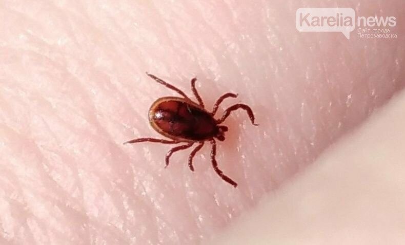 Клещи в Карелии укусили с начала года более 3000 человек