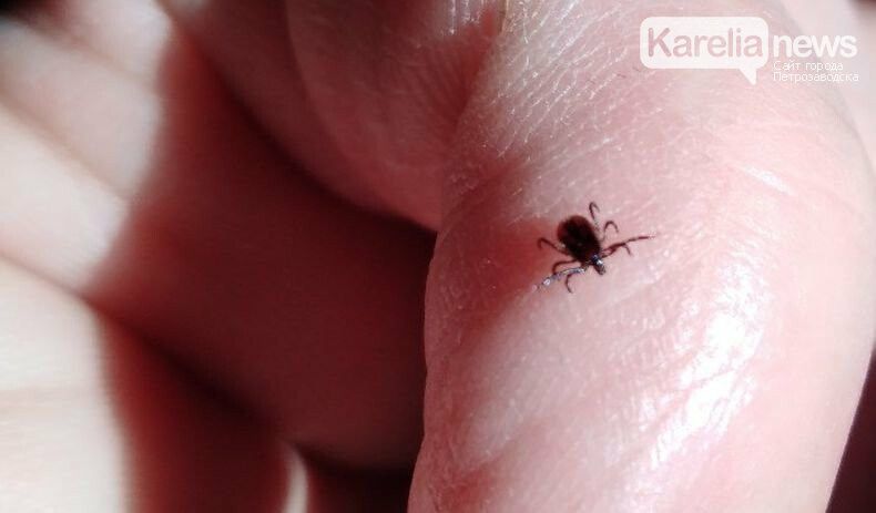 За неделю в Карелии не выявлено ни одного случая заболевания клещевыми инфекциями