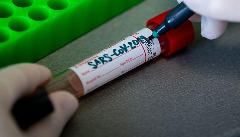 В России рекордное число заболевших за сутки коронавирусом. Смотрим, как у соседей Карелии