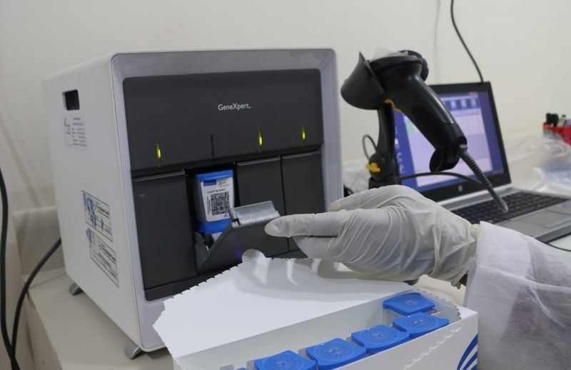 Первые 30 сверхбыстрых тестов на коронавирус дали отрицательный результат