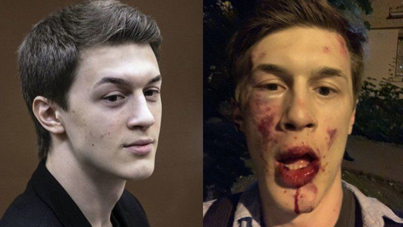 Оппозиционного журналиста и популярного блогера Егора Жукова жестоко избили в Москве