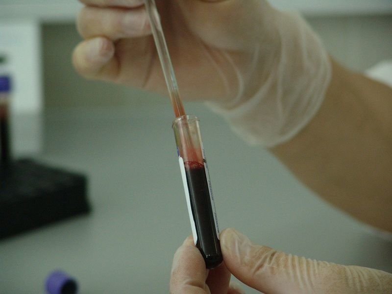 Более 150 жителей Карелии заразились ВИЧ-инфекцией в 2020 году